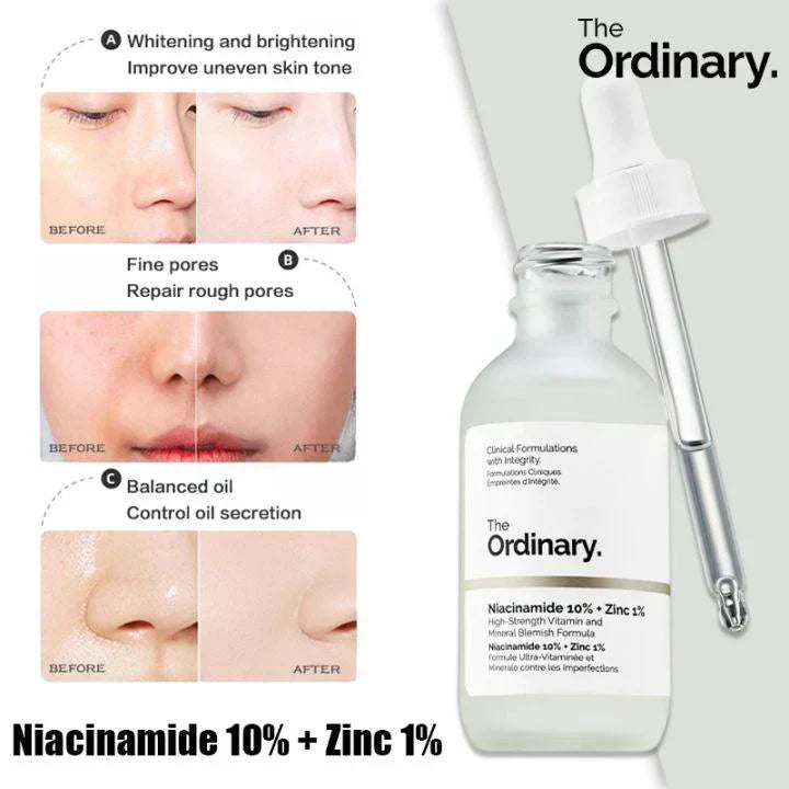 The Ordinary Niacinamide 10% + Zinc 1%