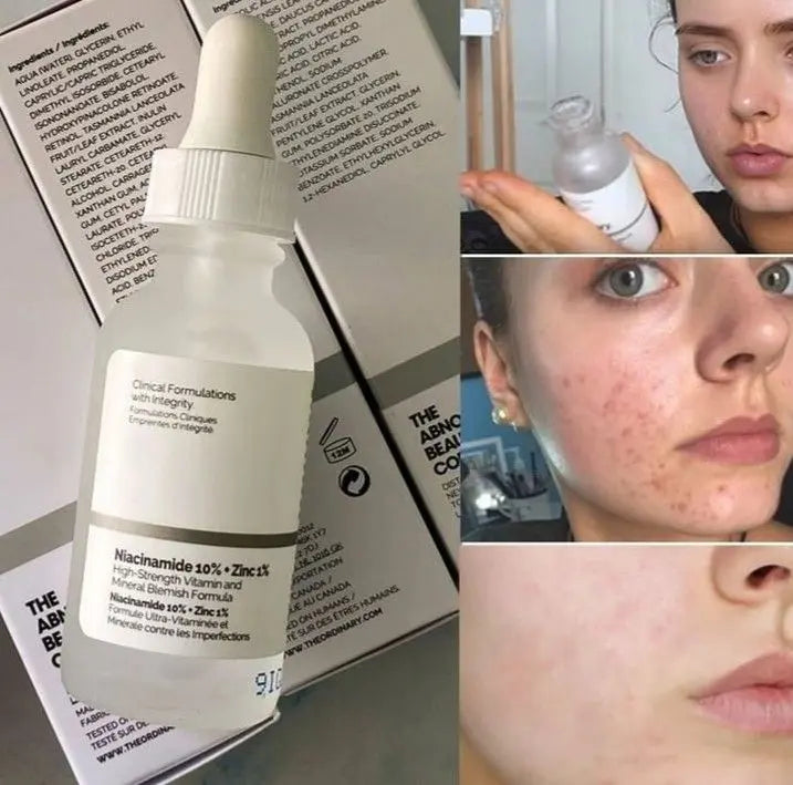 The Ordinary Niacinamide 10% + Zinc 1%